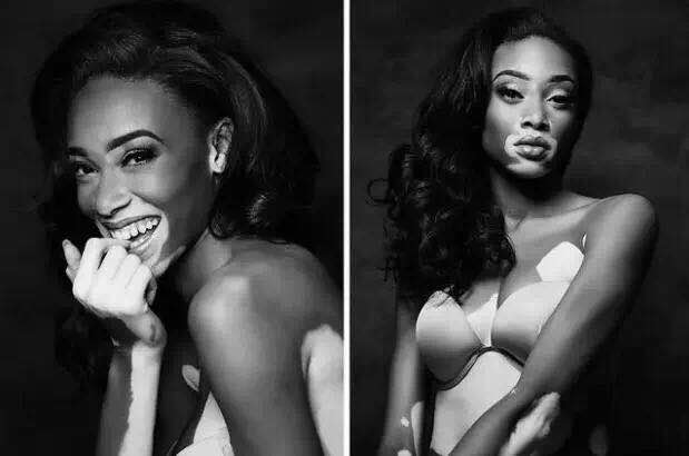 Winnie Harlow