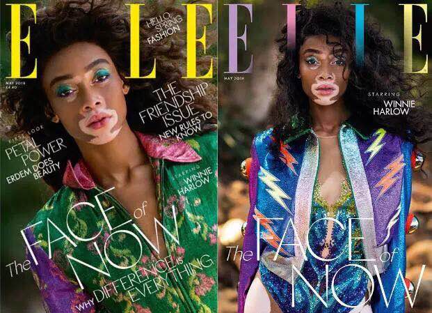 Winnie Harlow