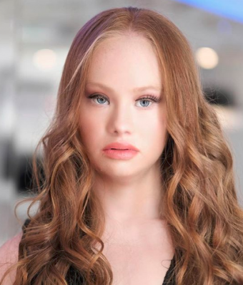 第一位患“唐氏综合症”的职业模特，身高仅1米49，身残志不残！